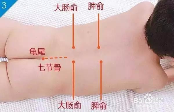 宝贝便秘这个通便的学位百试百灵