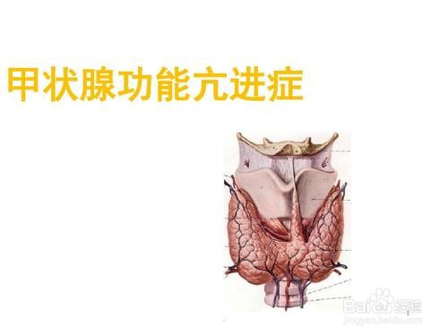 甲亢药物治疗注意事项