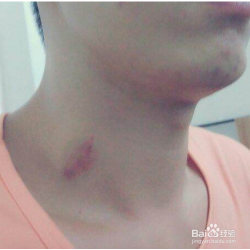 怎样用化妆做假吻痕 ?