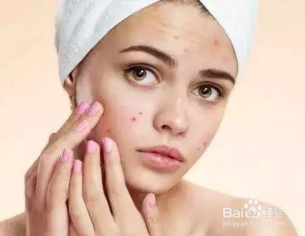 什么去痘印管用?分清类型有效祛痘印