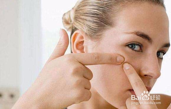 生痘痘了怎么办