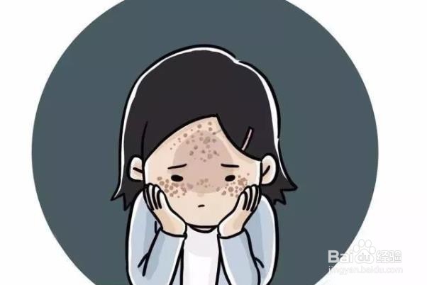 孕期如何避免黄褐斑