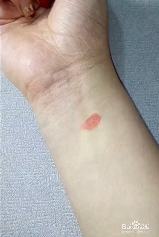 治疗晕车有什么小办法