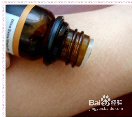 怎么去腿上的肥胖纹