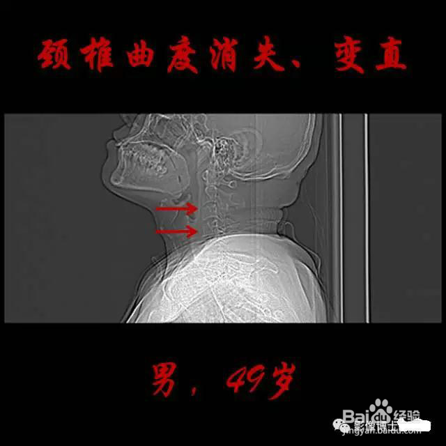乳胶枕的好处 作用
