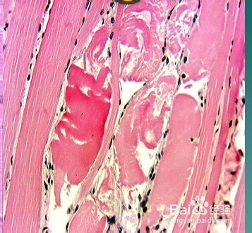 关于心肌疾病的临床图片。