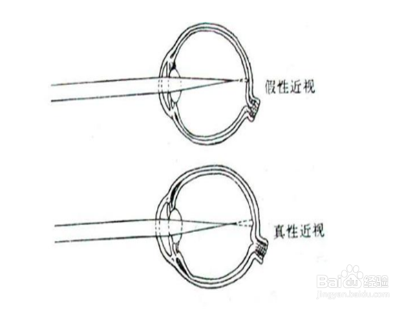 如何让孩子有一个良好的视力