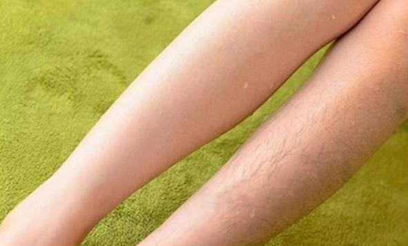 用脱毛膏有什么副作用吗