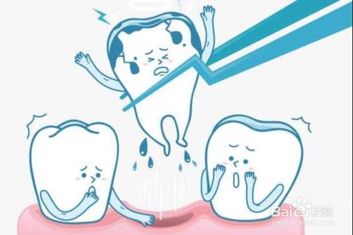 拔牙之前要注意哪些问题