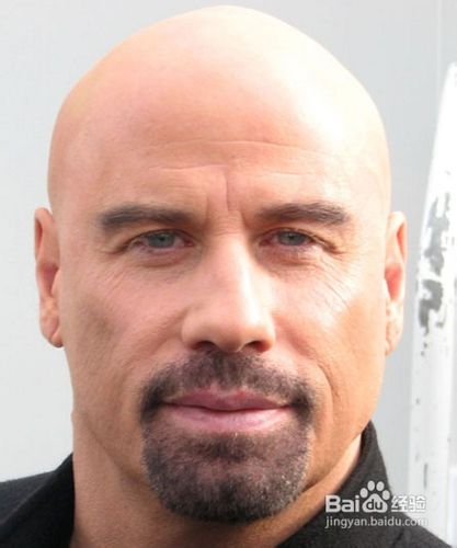 掉头发怎么办啊