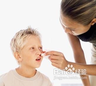 流鼻血时怎么办流鼻血时的急救方法