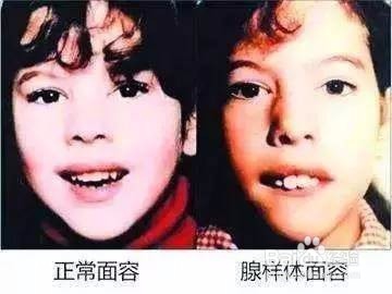 儿童打呼噜怎么办?不如试一下智能止鼾抱枕
