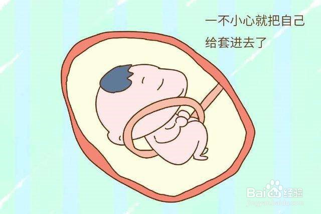 这样做会加重胎儿脐带绕颈情况