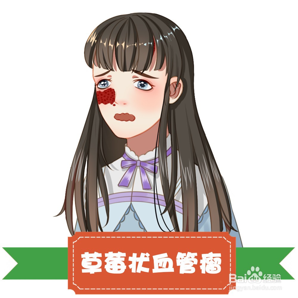 如何治疗胎记