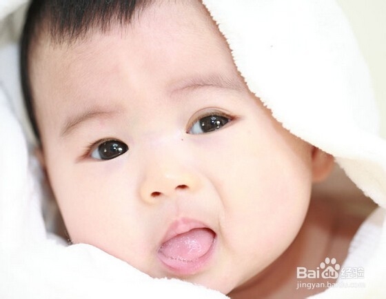 婴儿奶癣治疗的各种方法大全