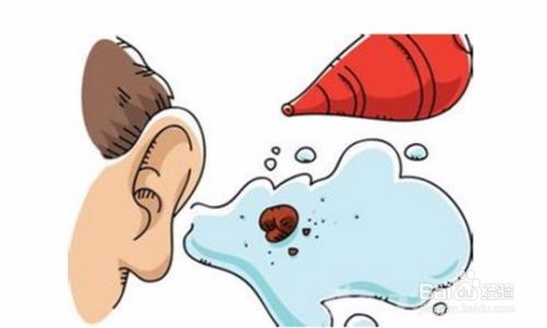 耳朵进水了怎么办?