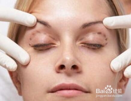 如何去眼袋比较有效