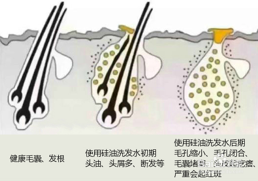 洗发水中的硅油是什么？