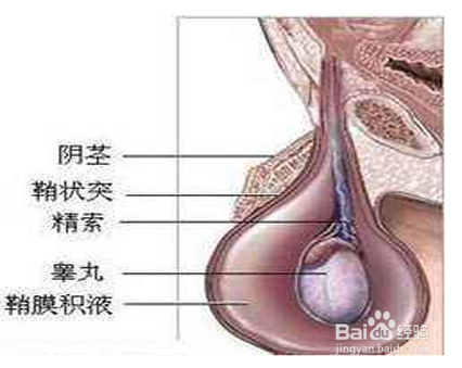 小儿鞘膜积液有哪些表现?