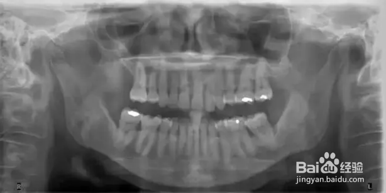 优梨美牙的牙周检查内容