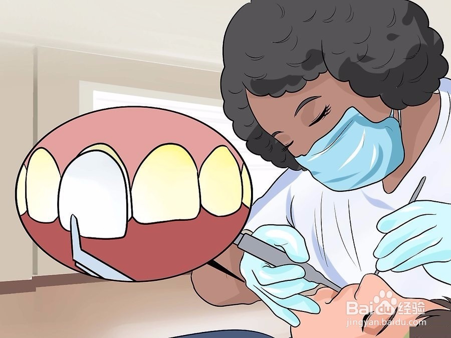 如何修复牙釉质