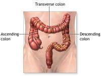 大便出血的原因——六大肛肠疾病