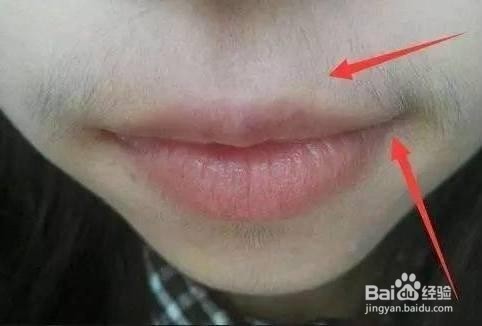 女性有妇科疾病的表现