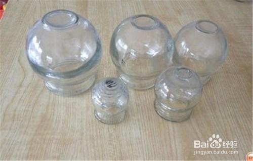 如何正确拔火罐