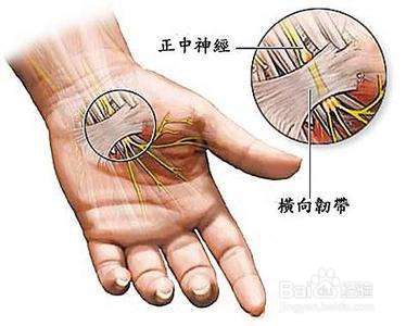 手指肿胀 可能是这六大原因