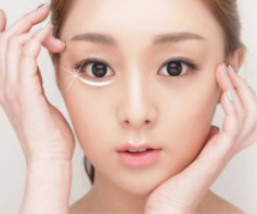如何去除眼袋小窍门