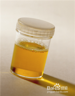 高血压患者哪些项目是必须检查