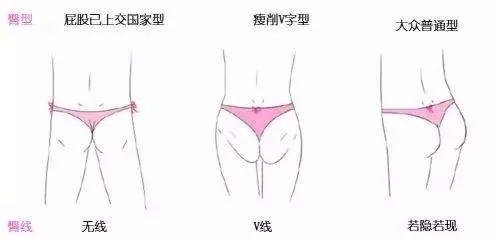 “死臀综合征”有救吗