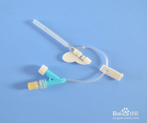 如何使用留置针 百度经验 如何使用留置针 百度经验