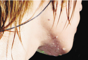 糖友夏季饮水误区