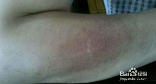 身体去角质的小常识 百度经验