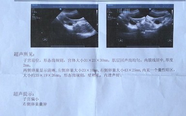 如何减少怀孕期间的相关费用