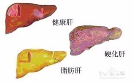 用构杞防病治病 及养生方法