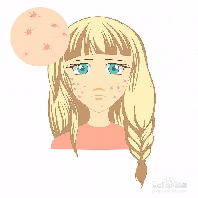 生痘痘了怎么办