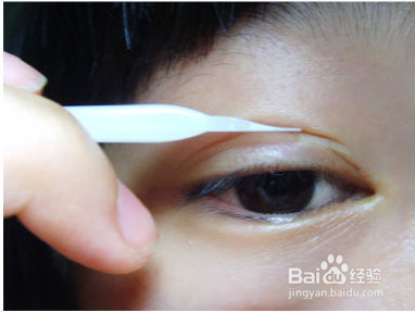 内双变成开眼角双眼皮的技巧