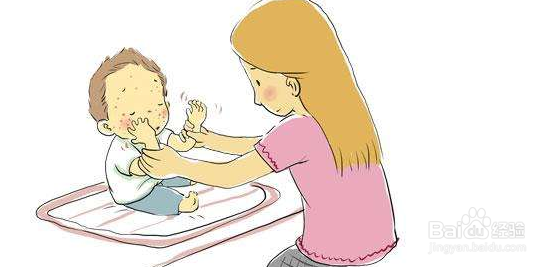 宝宝湿疹引发的原因是什么,怎样护理