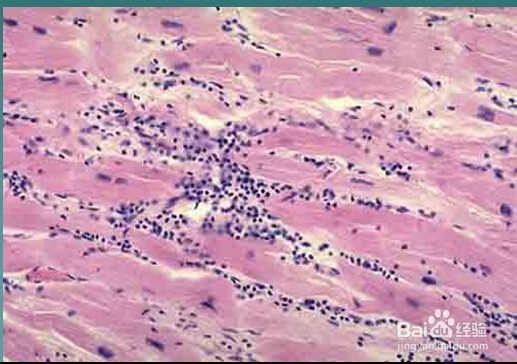 关于心肌疾病的临床图片。
