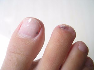 从你的手指头就可以看出健康问题!准爆!