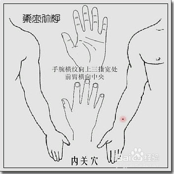 失眠有七种 一招就搞定