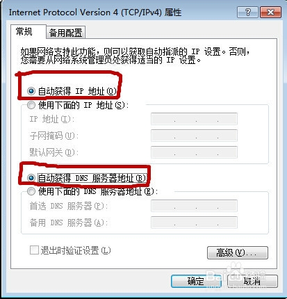 win7自动获取IP地址的方法，图解
