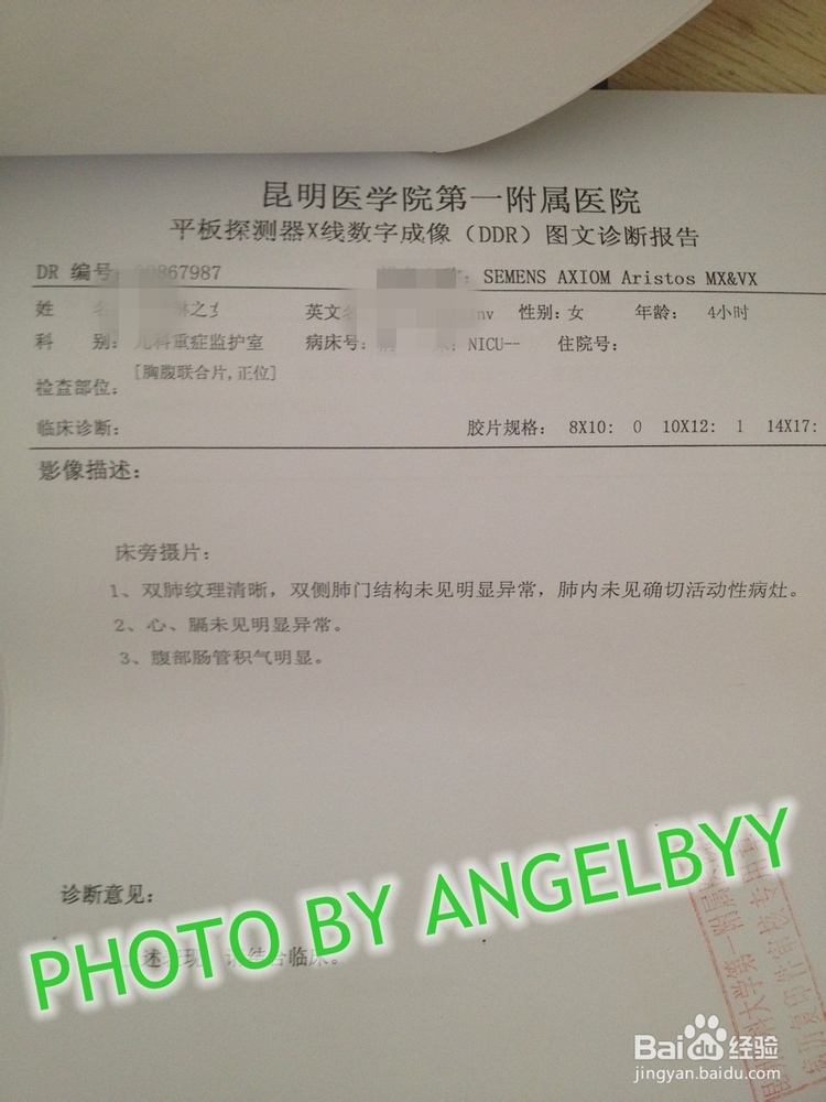 家有早产儿之呼吸暂停等问题