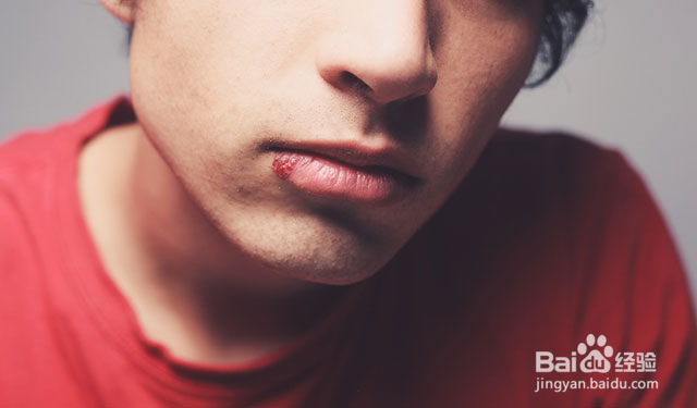 嘴上为什么会起水疱?