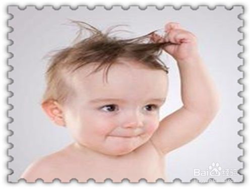 宝宝头发稀疏发黄怎么办？