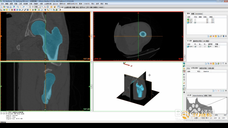 Mimics如何进行图像处理操作