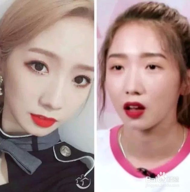 超声小气泡都有什么作用?