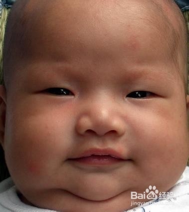 人体哪些部位最容易长胖